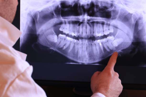 Best Root Canal Emergency Dentist  in Mansfield, LA