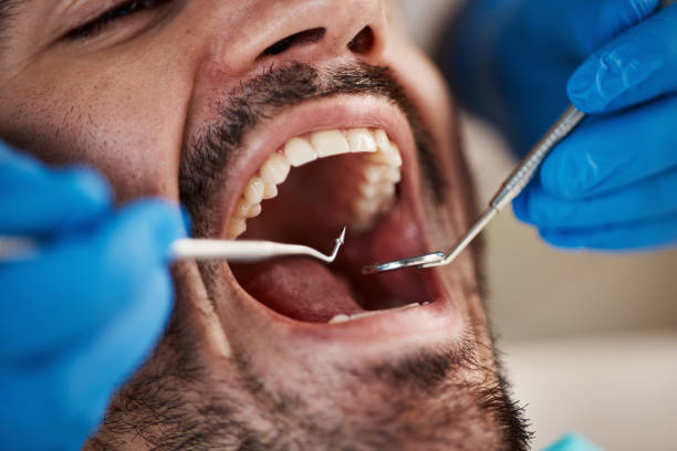 Best Root Canal Emergency Dentist  in Mansfield, LA